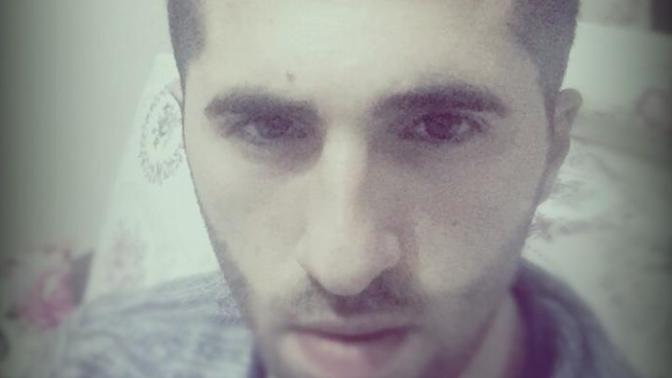 Çift çene ameliyatı elmacık kemiği ameliyatı olmalımıyım?