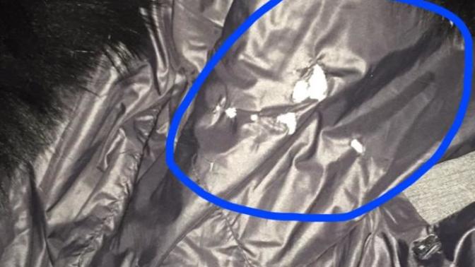 Sigara Yanığı Olan Mont (Acil)?