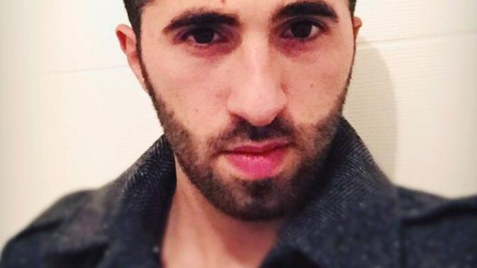 Arkdaşlar Nasıl sizce gideri  var mı bu arkadaşımızın Çift çene ameliyatı olucak zor bir ameliyatmı olanlar bilgi versin?