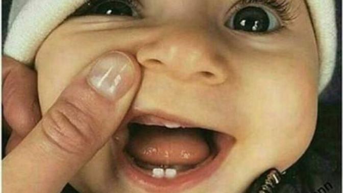 Bebeklerin ilk dişi neden hep alttan çıkar, üstten çıkan var mı?