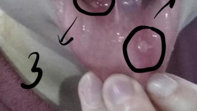 Anormal değil mi bu kadar iltihap çıkması ağzımda :'( ?