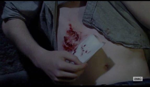 “The Walking Dead” izleyicisi olarak, yeni bölümde Rick’in oğlu Carl’ın zombi tarafından ısırılması hakkında düşünceniz nedir?