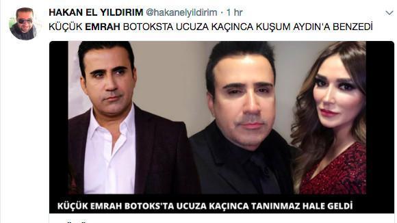 Emrah'ı görenler şoke oluyor botoks yaptırdı son hali bomba! Botoks yaptırınca Kuşum Aydın’a dönüşen Emrah'ı nasıl buldunuz?