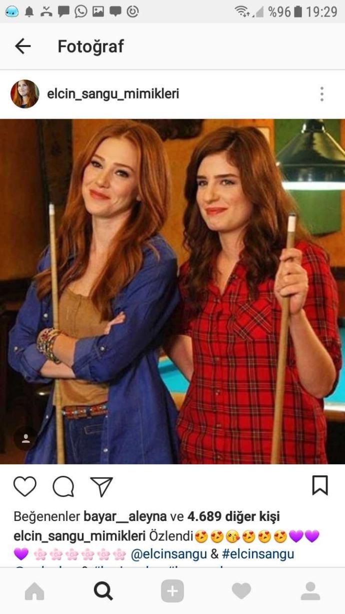 Elçin sangunun saçı??