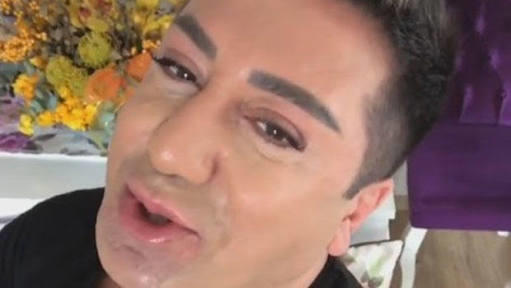 Erkek botox yapmalı mı?