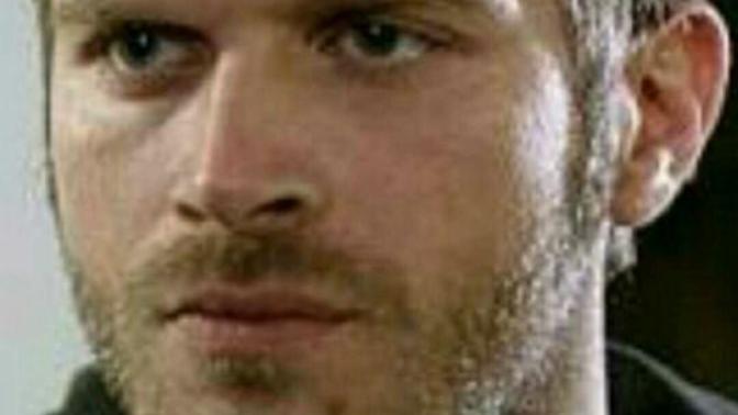 Kuzey Güney dizisinde Kıvanç Tatlıtuğ'un çenesindeki yara karizmamı?