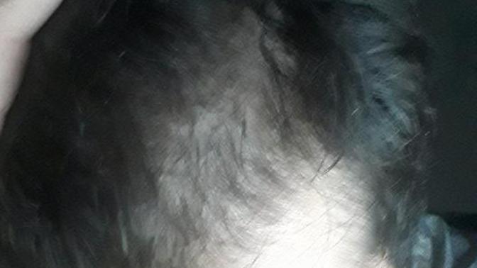 Saçlarım çok seyrek, acaba çok mu kafaya takıyorum bu durumu?
