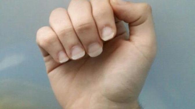 Gitaristim ve tırnaklarımla başım dertte?