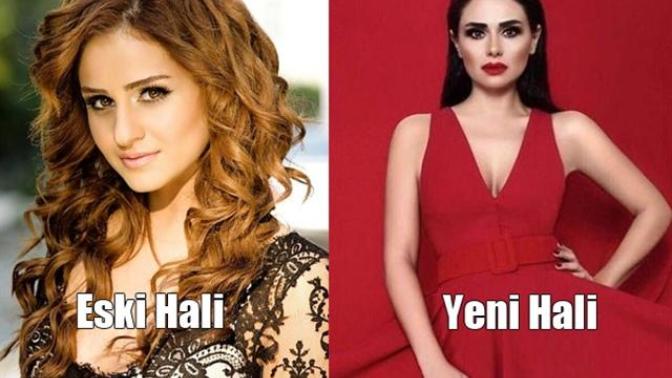 Azeri şarkıcı Günel Zeynalova nın sizce eski hali mi daha güzel yoksa yeni hali mi?