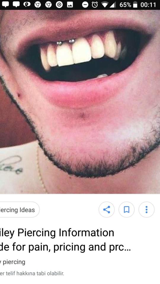 Kapalıyım ve smile piercing yaptirmak istiyorum??