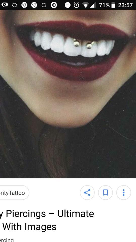 Kapalıyım ve smile piercing yaptirmak istiyorum??