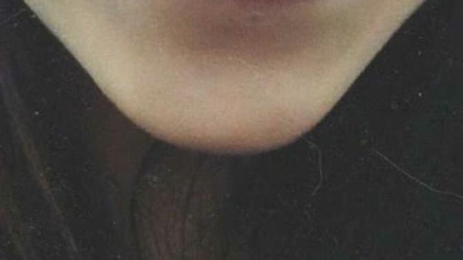 Kapalıyım ve smile piercing yaptirmak istiyorum?