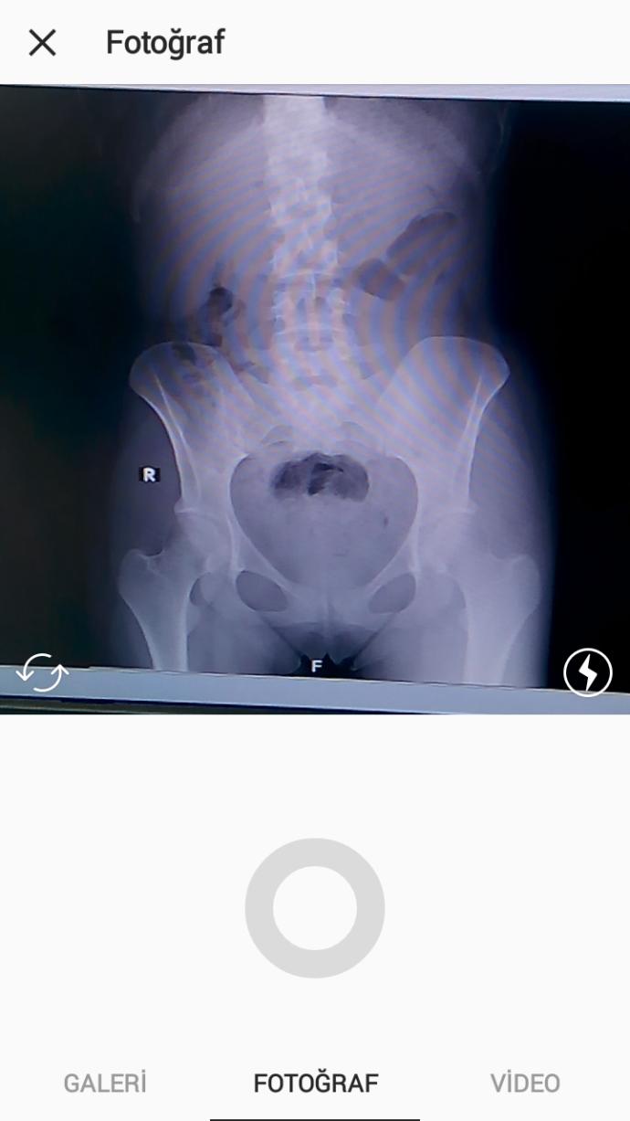 Röntgen okuyabilen doktor var mı?