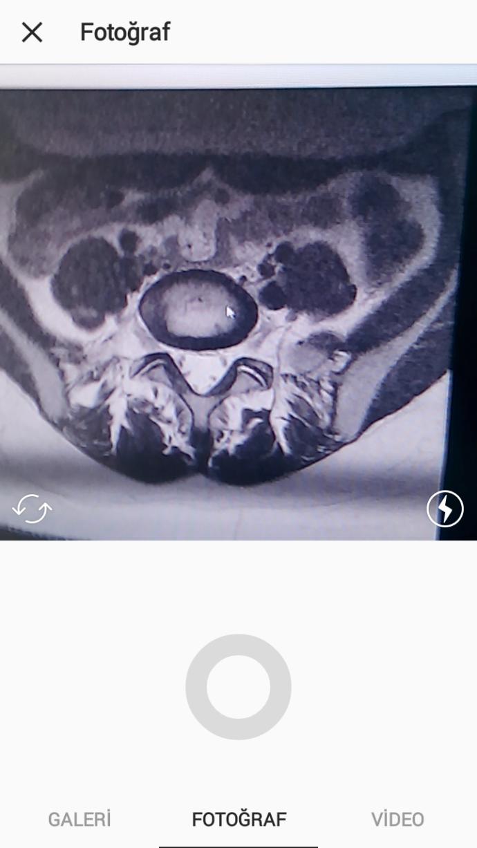 Röntgen okuyabilen doktor var mı?