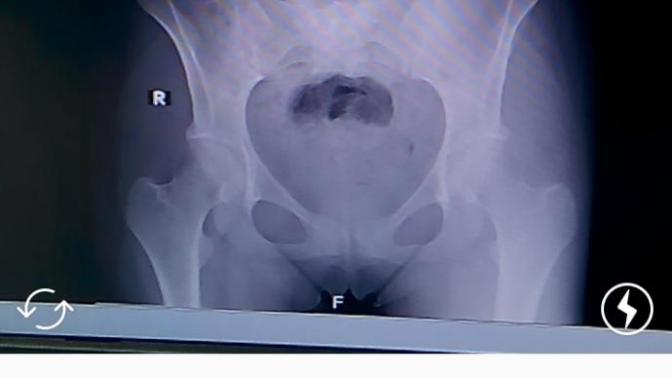 Röntgen okuyabilen doktor var mı?