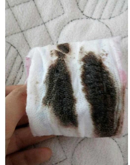 Erkeklerin regl olayını abartıyorsunuz lafları sinir bozucu değil mi?