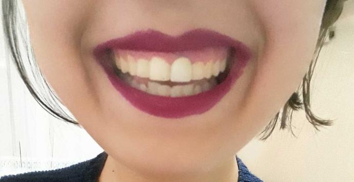 Smiley Piercing Sizce yakışır mı bana??
