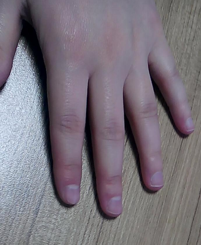 Ellerim ve tırnaklarım çok mu bakımsız görünüyor?