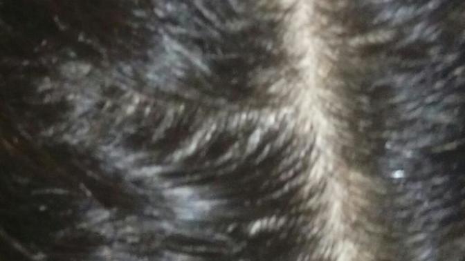 Saçımda sizce seyrelme var mı?