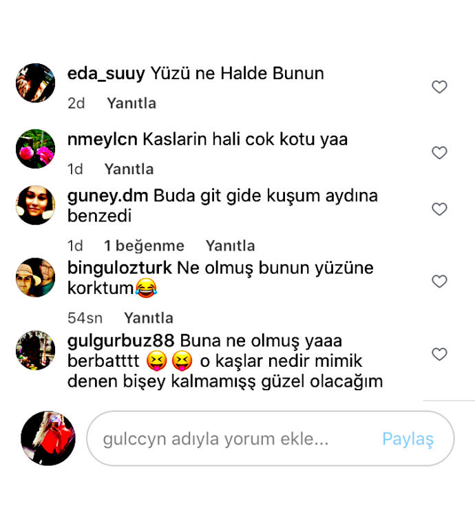 Hayaller Adriana, gerçekler Kuşum Aydın! Özlem Yıldız botoks mağduru. Sizce abartı isteyen mi, olmaz demeyip yapan mı kim suçlu?