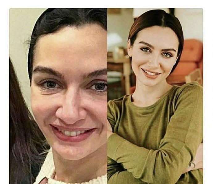 Birce akalayin burnu?