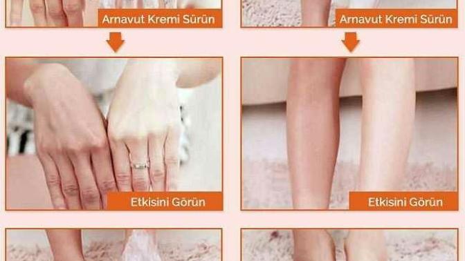 Arnavut kremi (aklık kremi)?