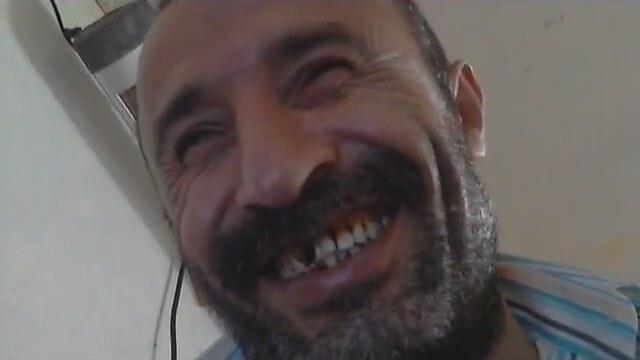 En seksi kusur: Ayrık dişler! Kadınlarda ayrık dişler itici mi yoksa çekici mi?