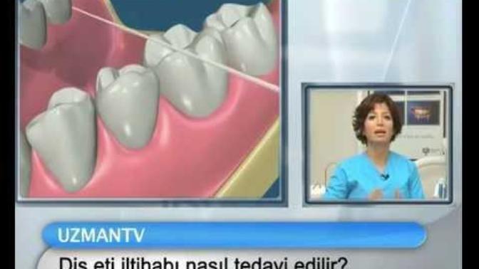 Devlet hastanesi küretaj (diş eti iltahabı tedavisi) yapar mı?