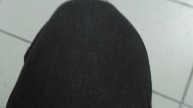 Arkadaslar diz kemiginde  ya da  kapak nasil deniyorsa iste bir yamuklukmu var bir bakin?