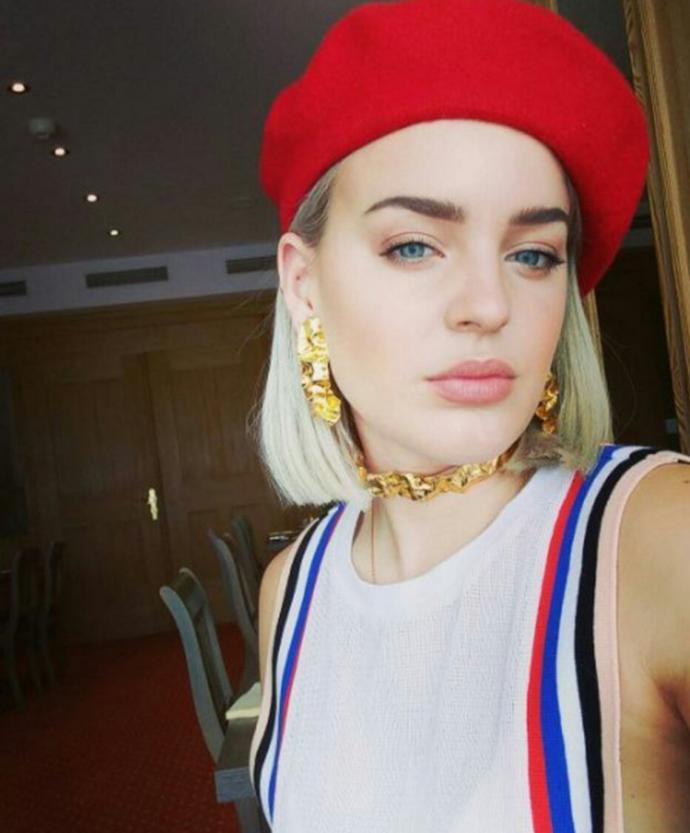 Sizce de Anne Marie çok güzel değil mi?