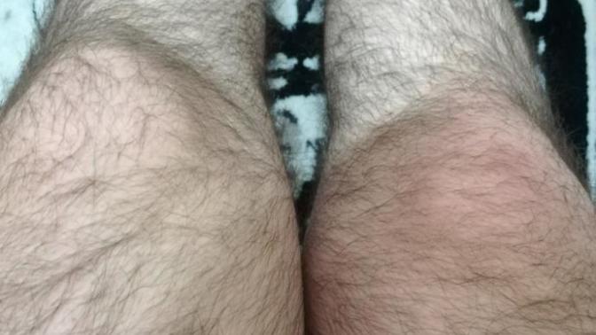 Sizce bacaklarım çok mu kıllı yoksa bir erkek bacağına göre normal mi?