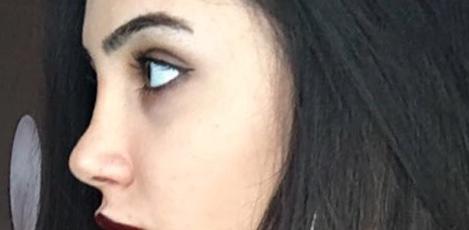 Burun estetiği sonrası çok pişman oldum ne yapabilirim?