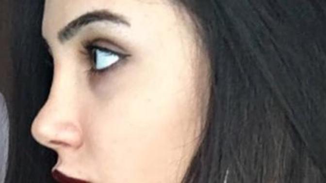 Burun estetiği sonrası çok pişman oldum ne yapabilirim?