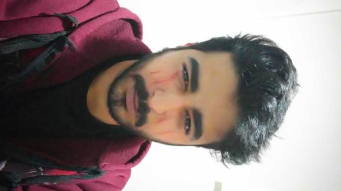 Arkadaşlar tırnak izi nasıl gider bilgisi olan yardım lütfen?