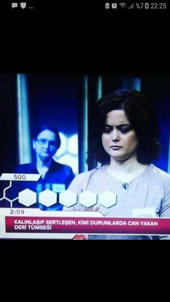 Kalınlaşıp  sertleşen ,kimi durumlarda can yakan deri tümseği nedir?