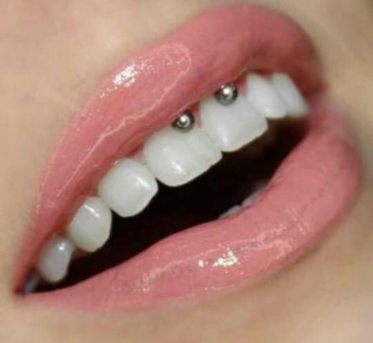 smiley piercing'in sağlığa zararları var mıdır varsa bunlar neler??