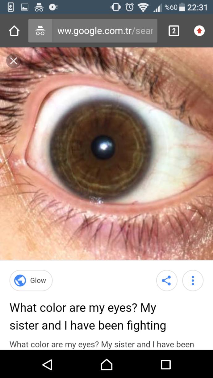 Kahverengi gözlerde yeşil çizgiler var mı?