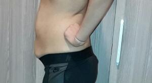 Bu gobek ameliyatlik mi sporla duzelir mi?