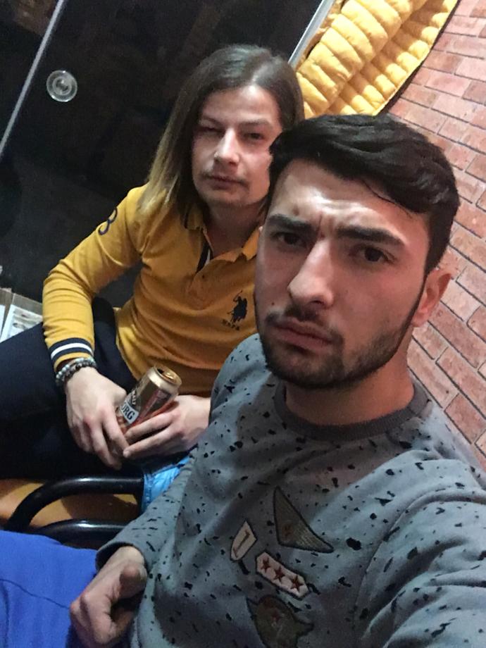 Kısık gözlü erkekler çok yakışıklı değil mi?