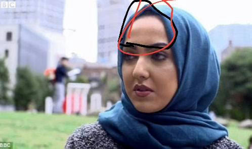 Turbanliların saclarinin ön tarafı neden kel oluyor ?