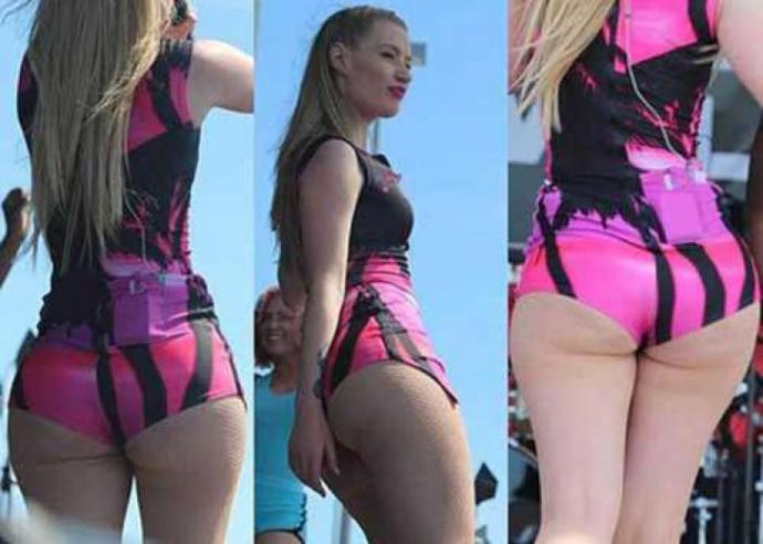 Nıckı MInaj mı yoksa Iggy Azale mı daha guzel kalcaya sahıb?