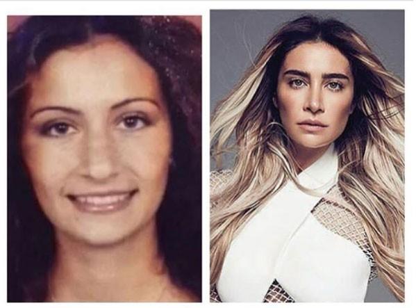 Hayranı olduğunuz ünlülerin meşhur olmadan önce ki estetiksiz hallerini gördünüz mü? Görmediniz mi?