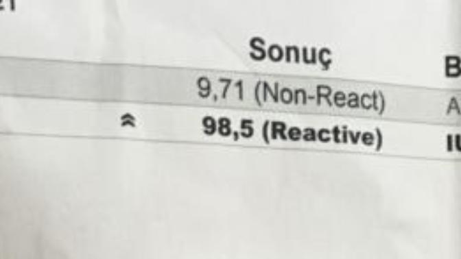 Toksoplazma gondii testi hakkında bilgisi olarak var mı? Bu test sonucu ne demek?