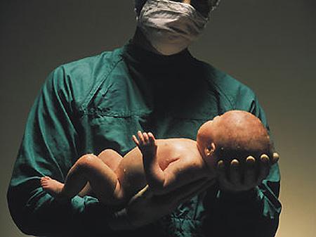Doğum sırasında erkek doktor istemeyen eşler için ne düşünüyorsunuz?