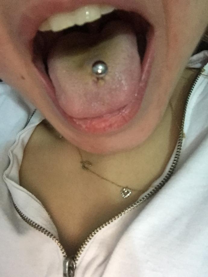 Dilimdeki piercing iltihap kaptı bakımı nasıl yapsam düzelir ?