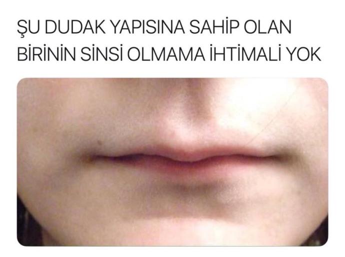 Kızlar, Bu dudak yapısına sahip kimler var çıksın :) ?