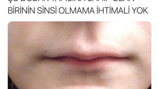 Kızlar, Bu dudak yapısına sahip kimler var çıksın :) ?