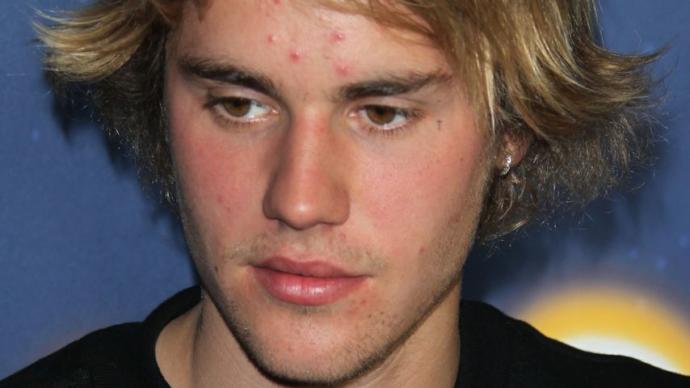 Sizce justin bieber neden bu hale geldi?