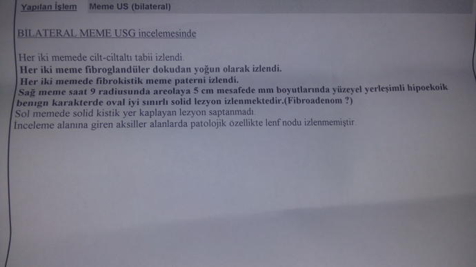 Mamografi sonucum böyle çıktı bilgisi olan var mı?