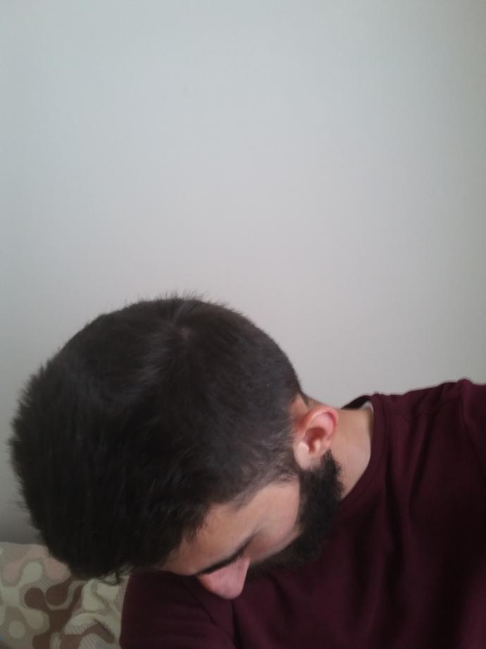 Saçım az mı çok takıntı yapıyorum bu konuyu?